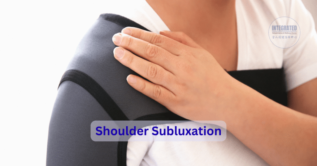 Shoulder subluxation showing hand support over the shoulder, commonly seen after stroke or neurological injury