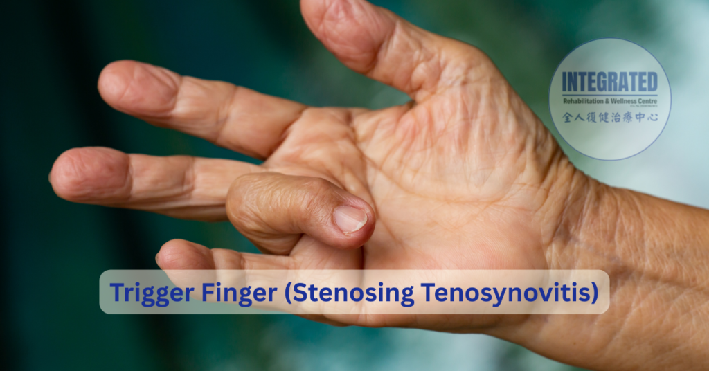 Trigger finger (stenosing tenosynovitis) with a visibly locked or bent finger position, demonstrating difficulty in smooth finger movement.